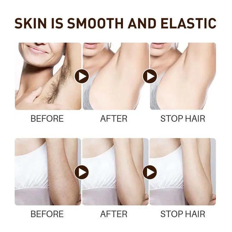 Hair Removal Spray for Arms, Legs, Underarms & Bikini Line