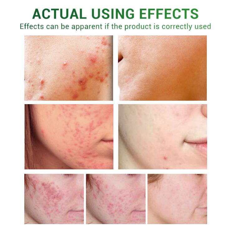 Plant Extract Skin Repair Face Serum – Lightweight Scar Appearance & Brightening Care