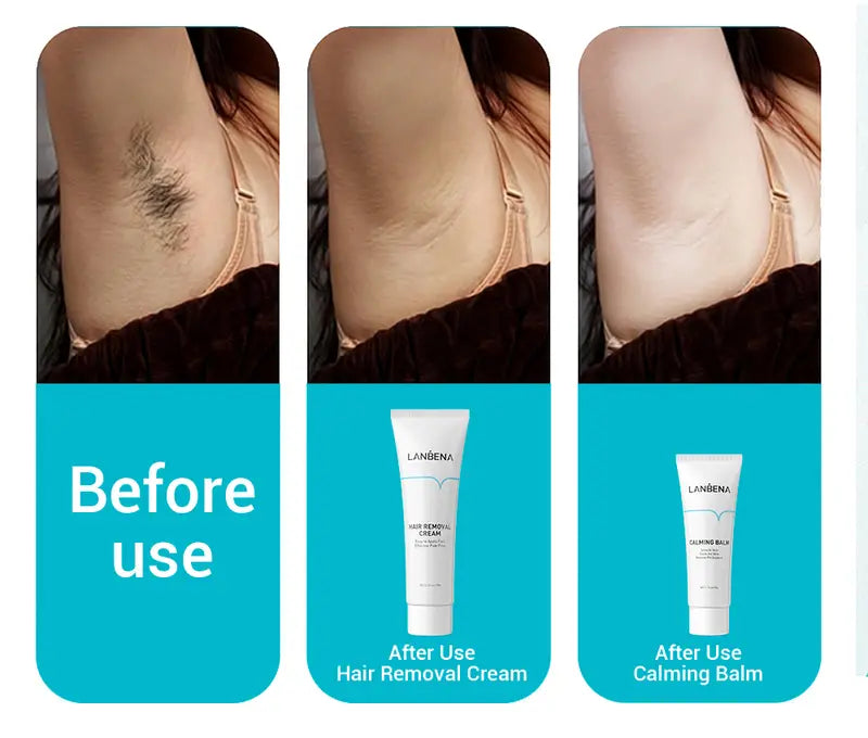 LANBENA Calming Balm – Aloe Vera Skin Care After Hair Removal