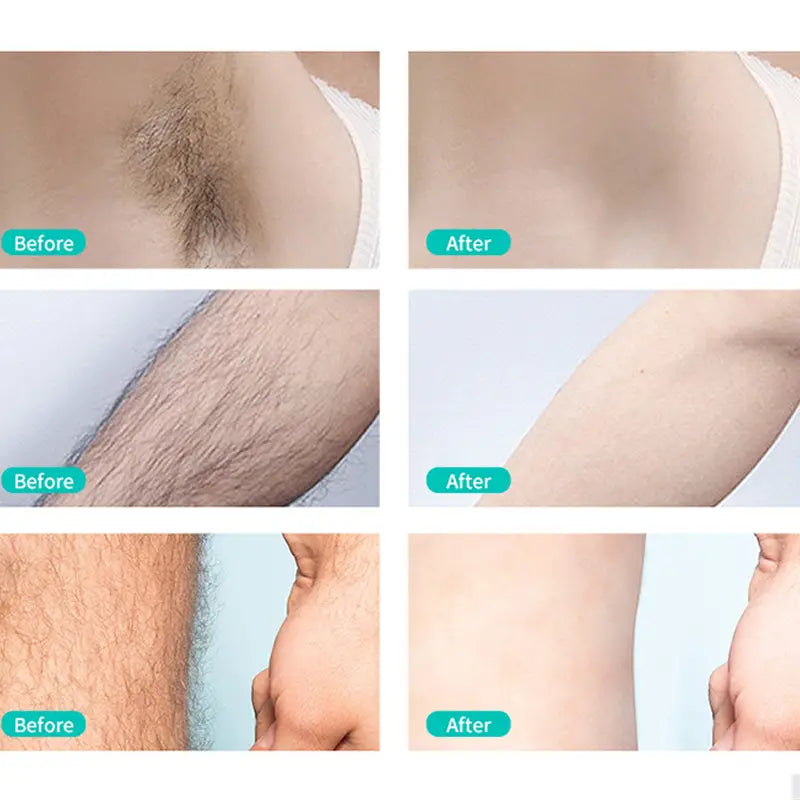 Hair Removal Cream for Body, Face & Sensitive Areas – 60ml