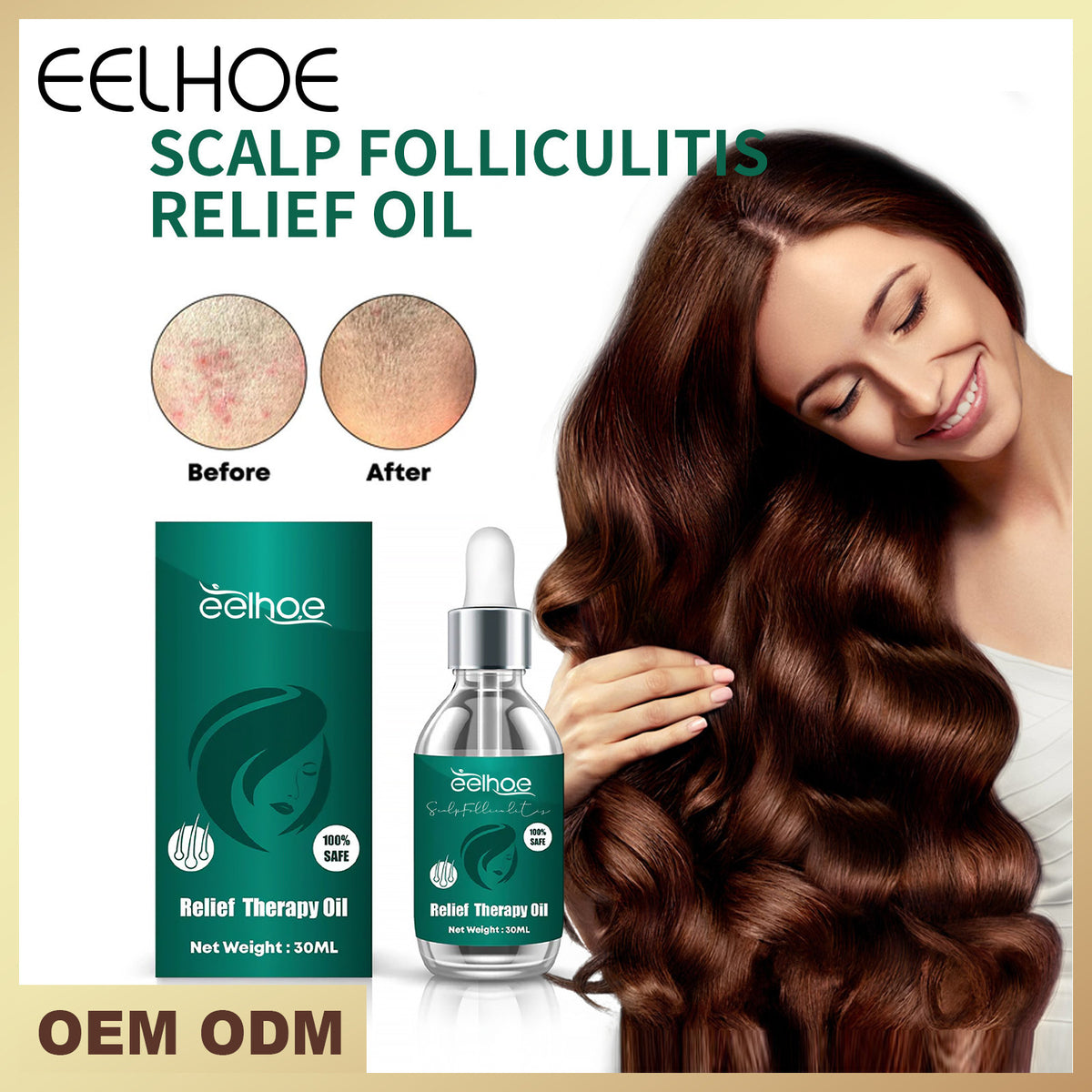 EELHOE Scalp Care Essence 30ml – Nourishing Hair & Scalp Oil for Frizz, Dandruff & Smooth Shine
