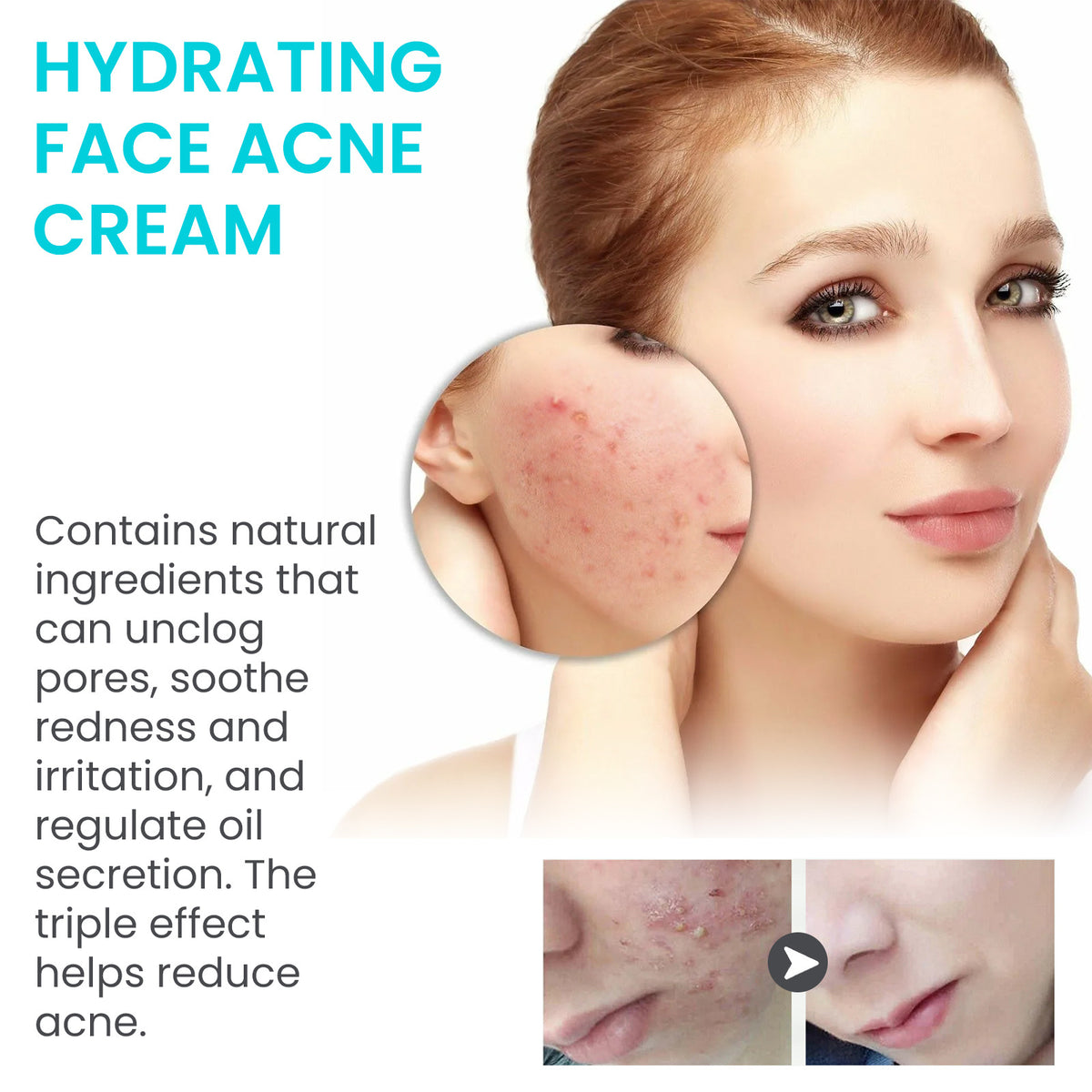 Jaysuing Brightening Blemish Care Cream 25g – Pore Refining & Moisturizing Face Care