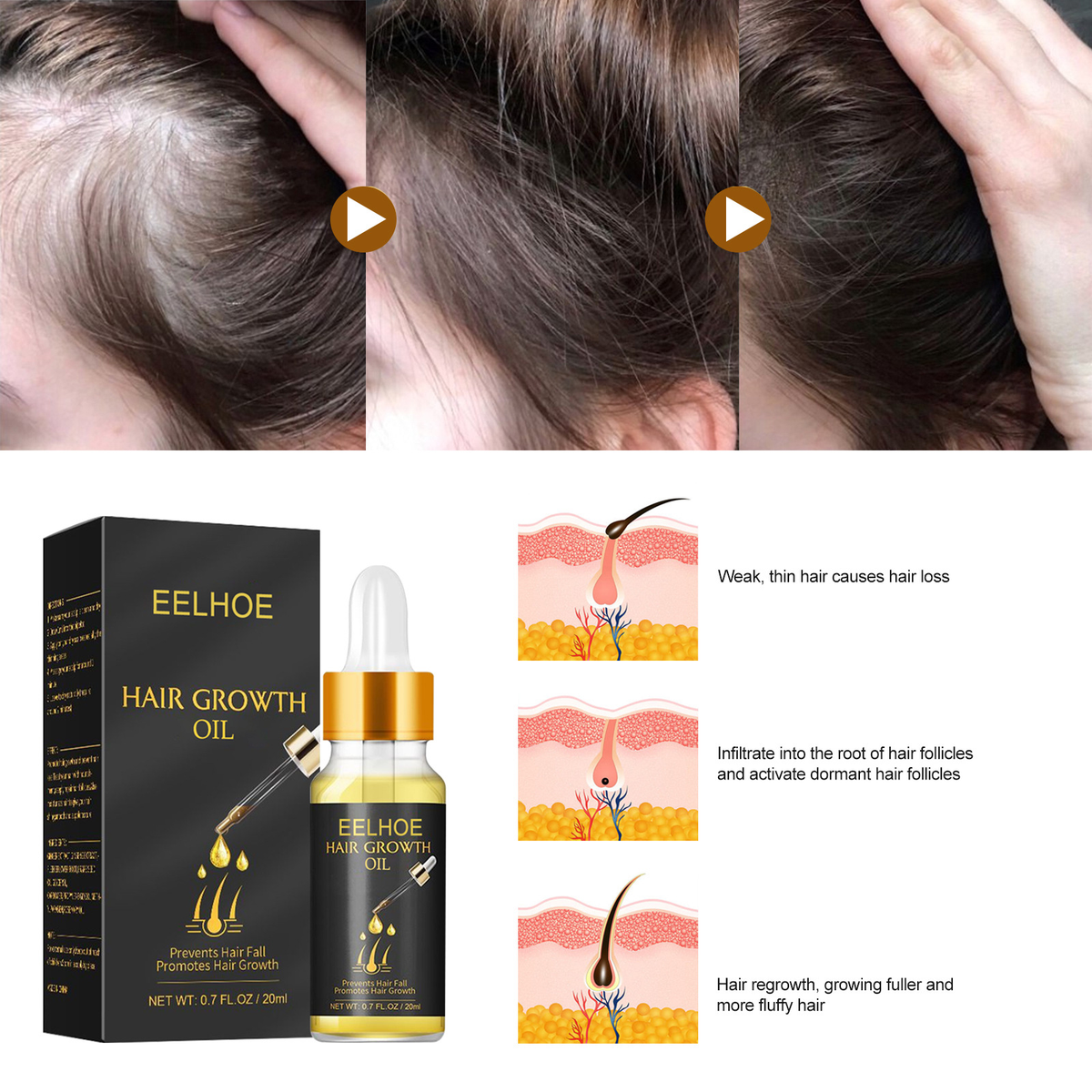 LAVDIK Hair Growth Serum Oil 20ml – Scalp Nourishing & Fuller-Looking Hair Care