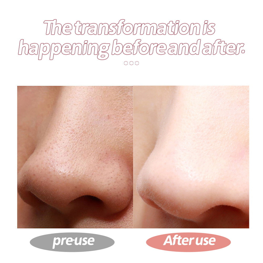 Ultrasonic Skin Scrubber – Rechargeable Pore Exfoliator for Home Facials