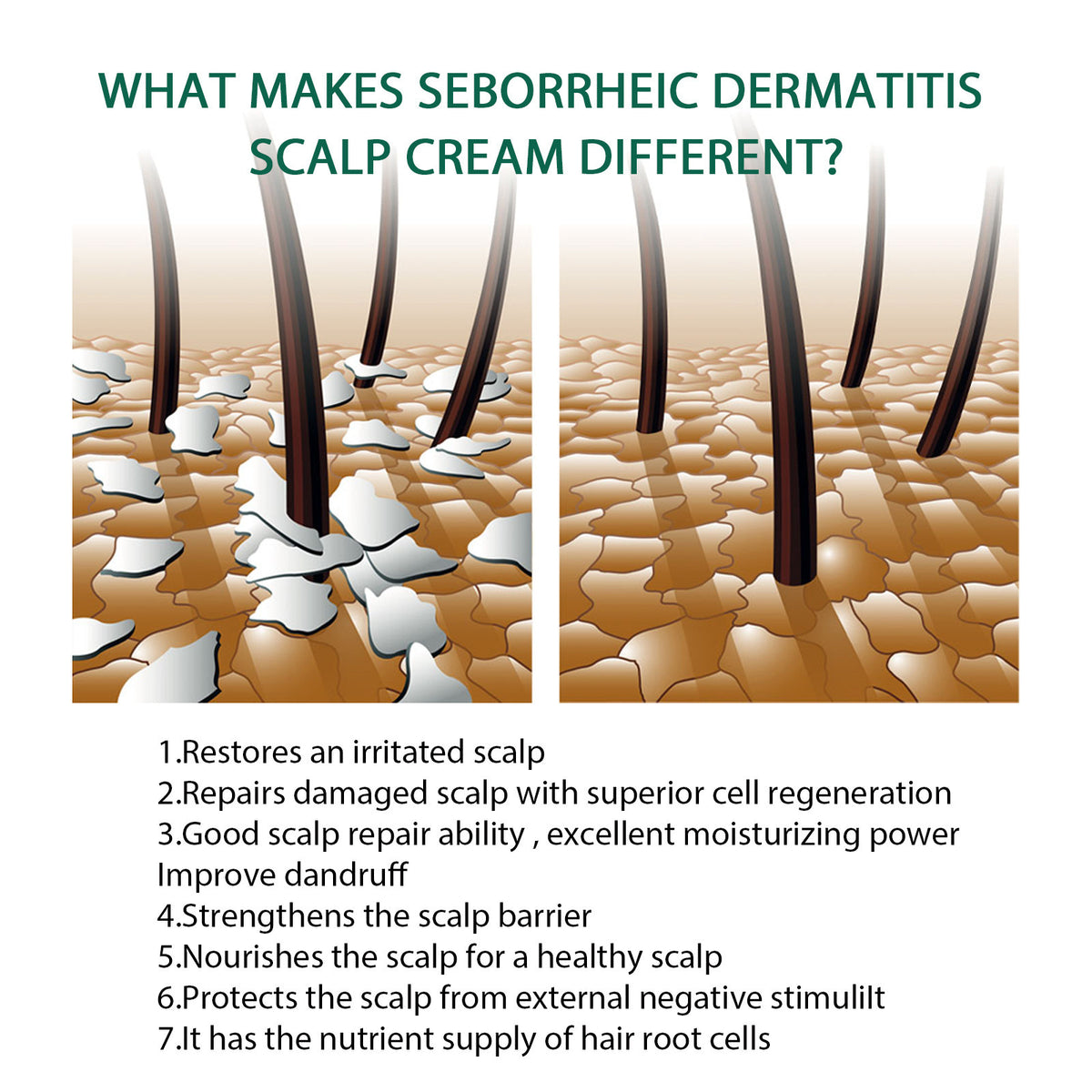 EELHOE Scalp Care Essence 30ml – Nourishing Hair & Scalp Oil for Frizz, Dandruff & Smooth Shine